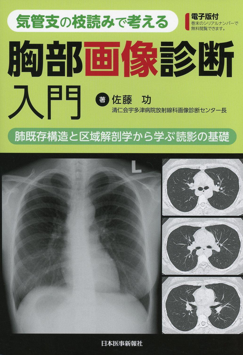 胸部のCT 第4版 - 健康・医学