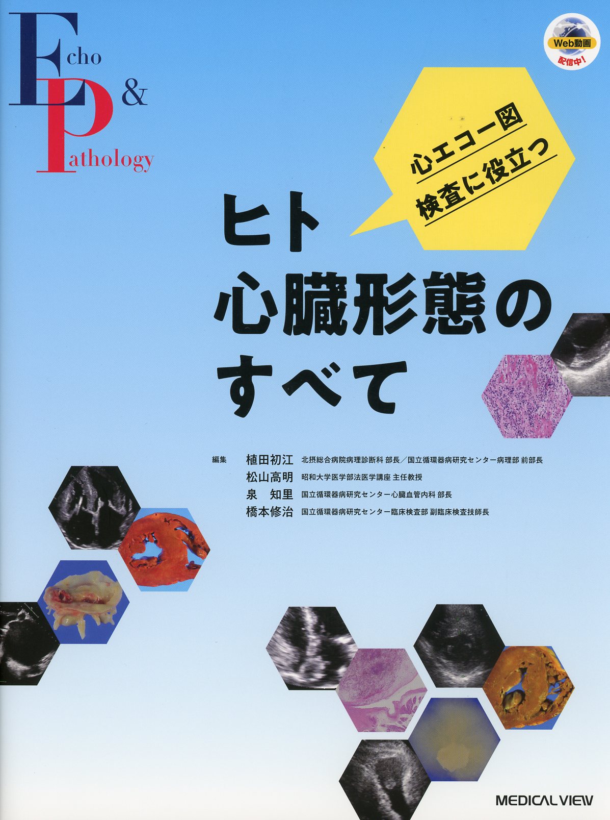 心エコー図検査に役立つ　ヒト心臓形態のすべて