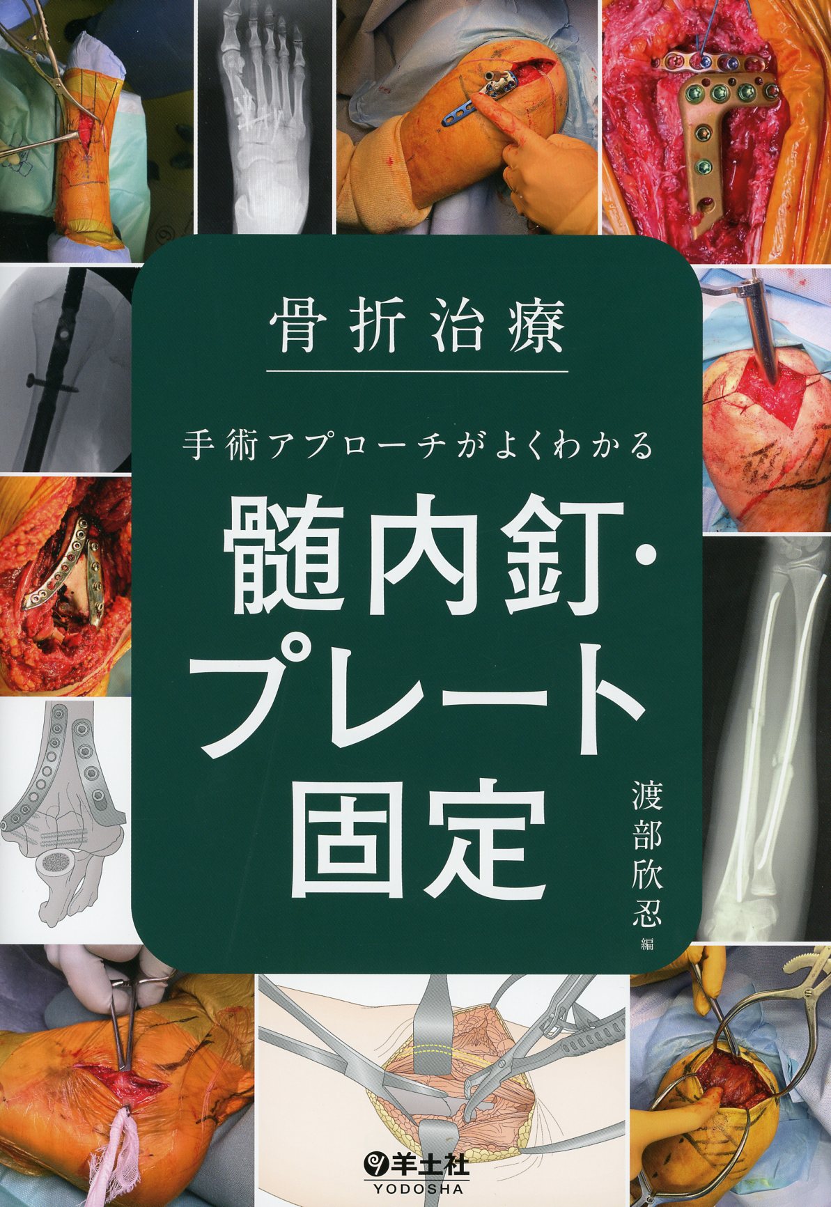 あす楽対応】 裁断済 最新版 整形外科 骨折プレート治療マイスター 