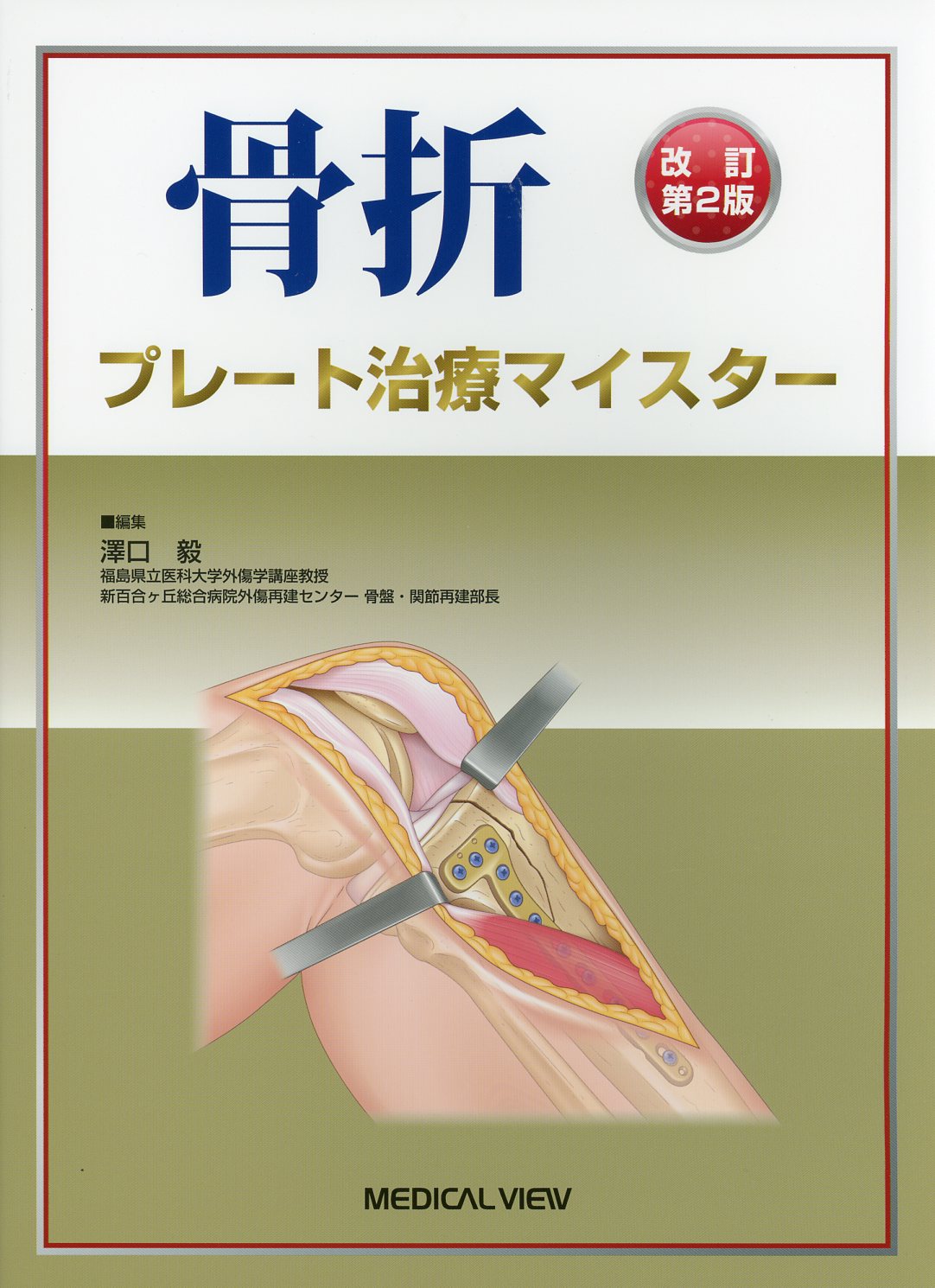 買い誠実 骨折 プレート治療マイスター 改訂第2版 健康・医学 - www ...