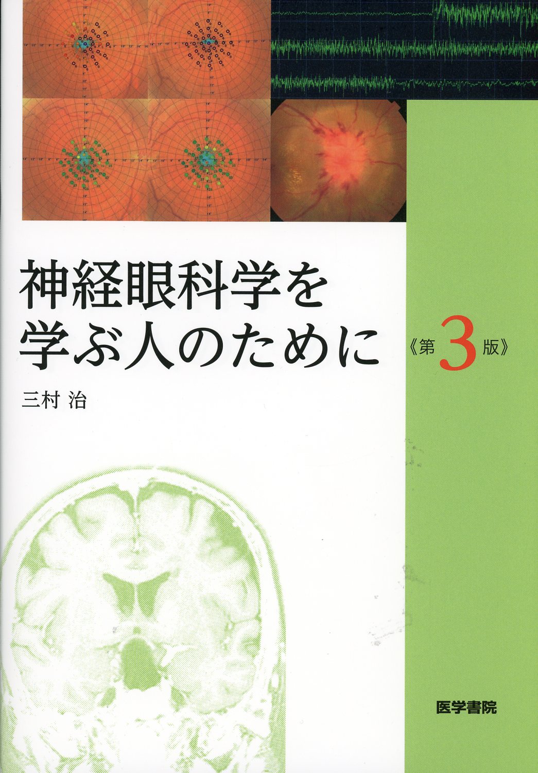 高陽堂書店　神経眼科学を学ぶ人のために　第3版