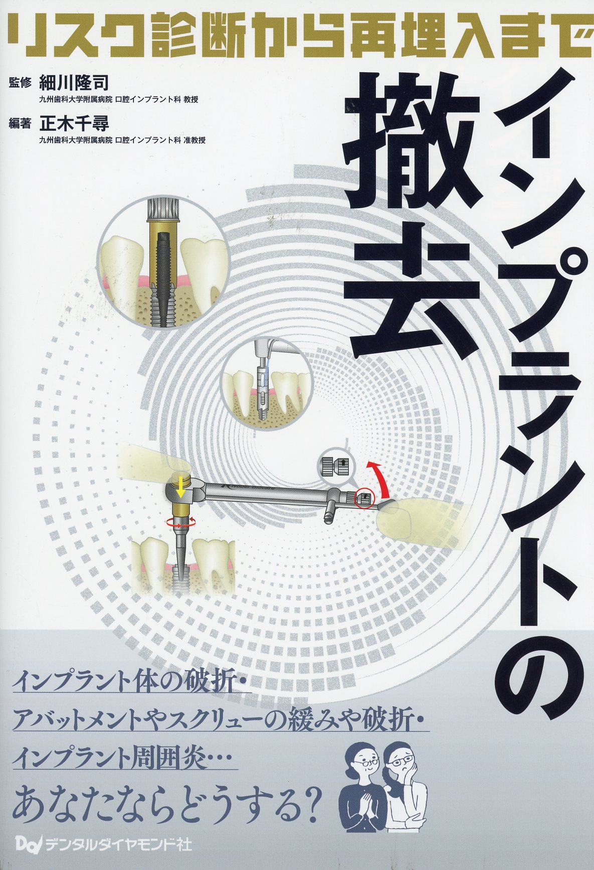 爆売り！】 【裁断済】リスク診断から再埋入まで インプラントの撤去 