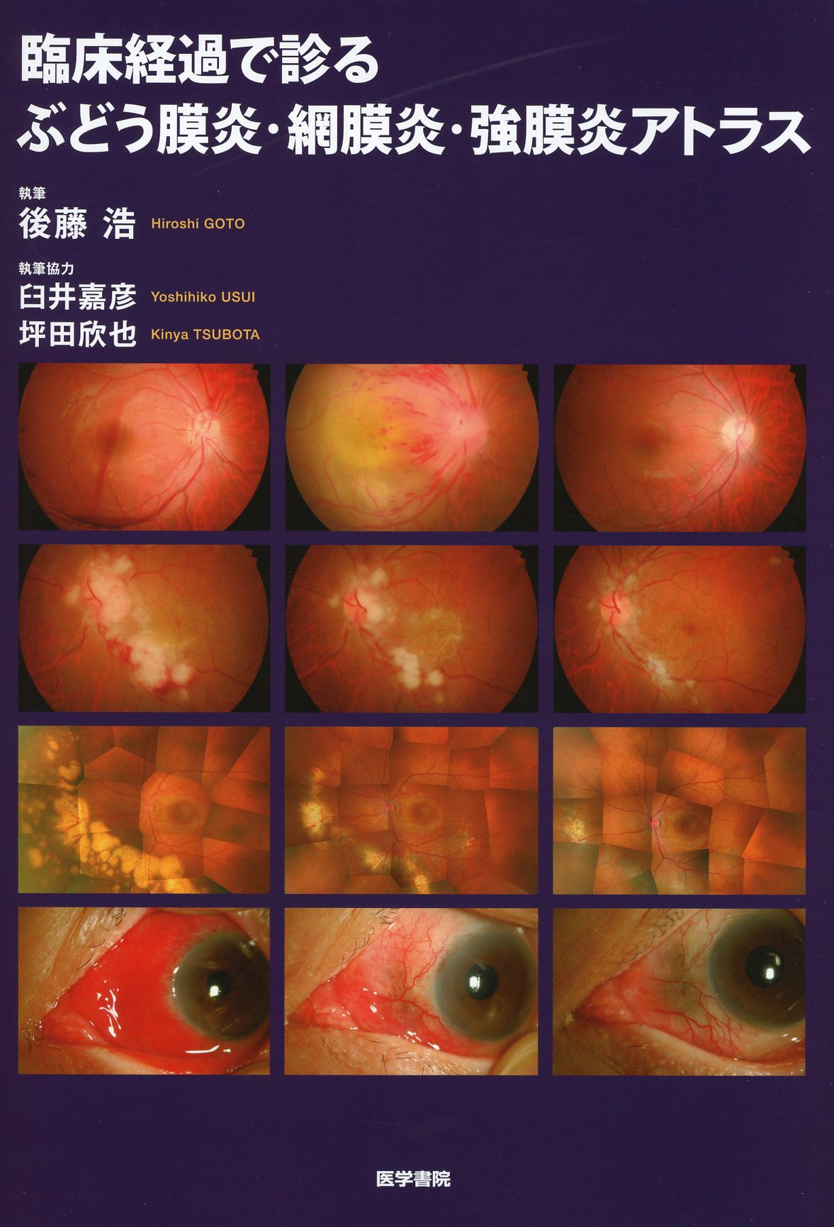 臨床経過で診る　ぶどう膜炎・網膜炎・強膜炎アトラス