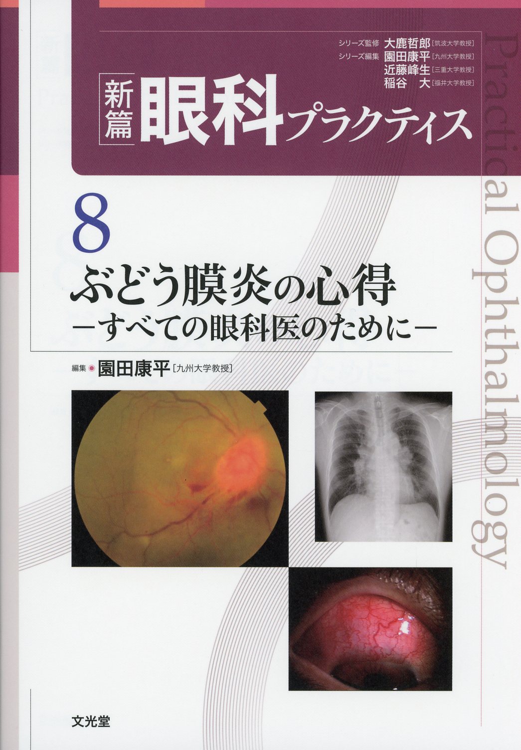 新篇眼科プラクティス　8　ぶどう膜炎の心得　すべての眼科医のために