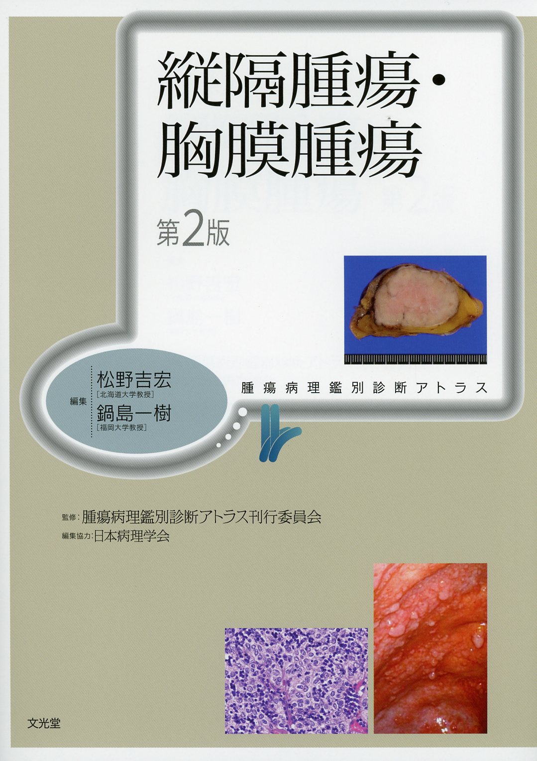 ラッピング不可】 新編口腔外科・病理診断アトラス その他 