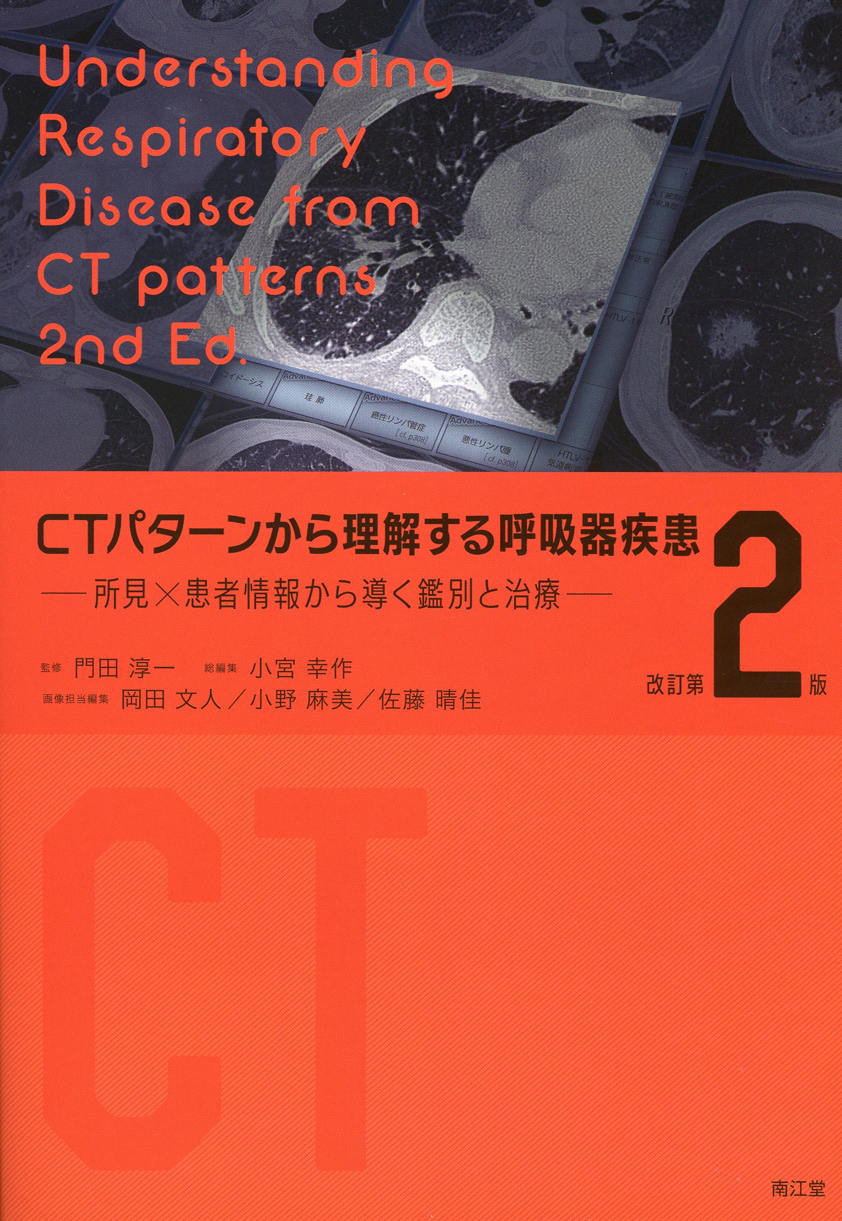 CTパターンから理解する呼吸器疾患 所見×患者情報から導く鑑別と治療 CTパターンから理解する呼吸器疾患(改訂第2版): 所見×患者情報から導く