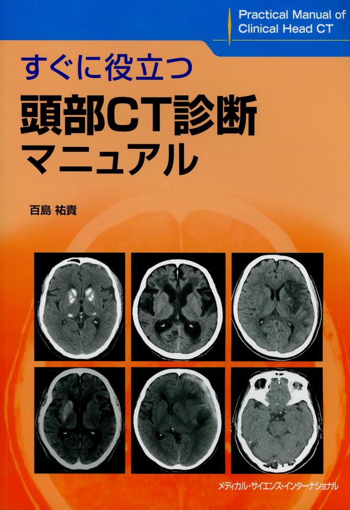天ブックス: 臨床心臓CT学 - 基礎と実践マネージメント - 小山靖史 ...