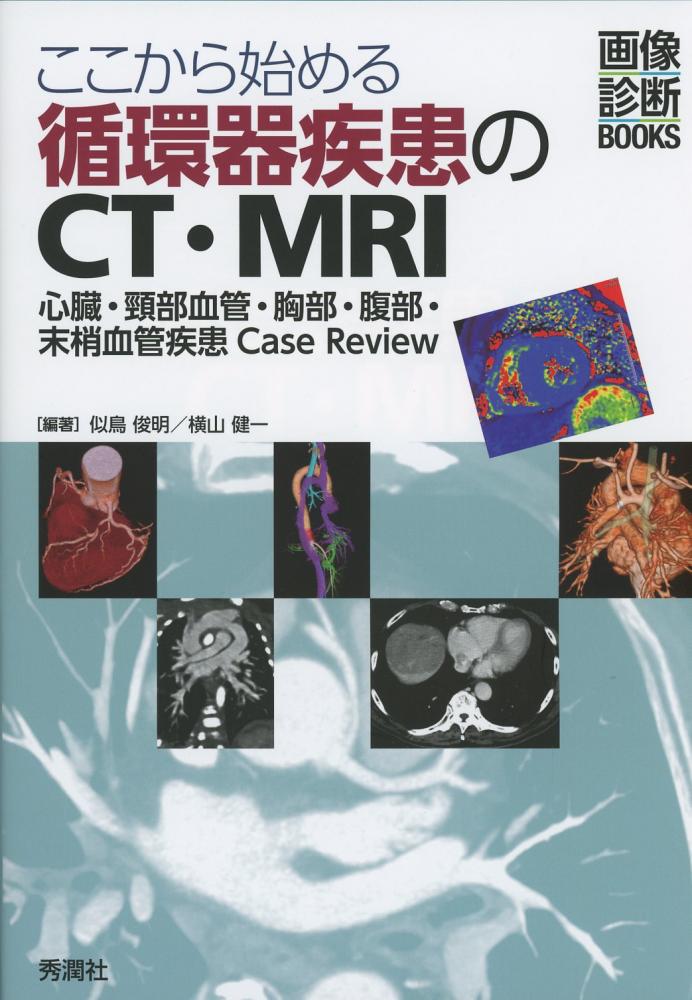 ここから始める循環器疾患のCT・MRI　Review　心臓・頸部血管・胸部・腹部・末梢血管疾患Case　高陽堂書店