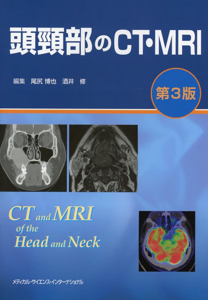 頭頸部の臨床画像診断学(改訂第4版) - 語学/参考書