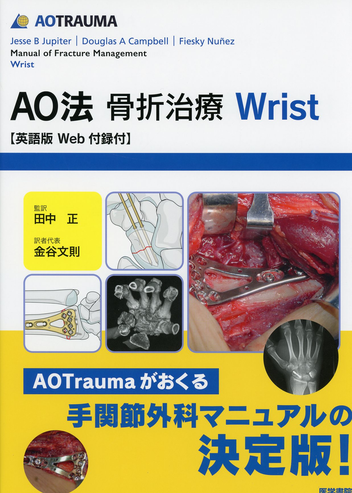 AO法骨折治療 Wrist　英語版Web付録付