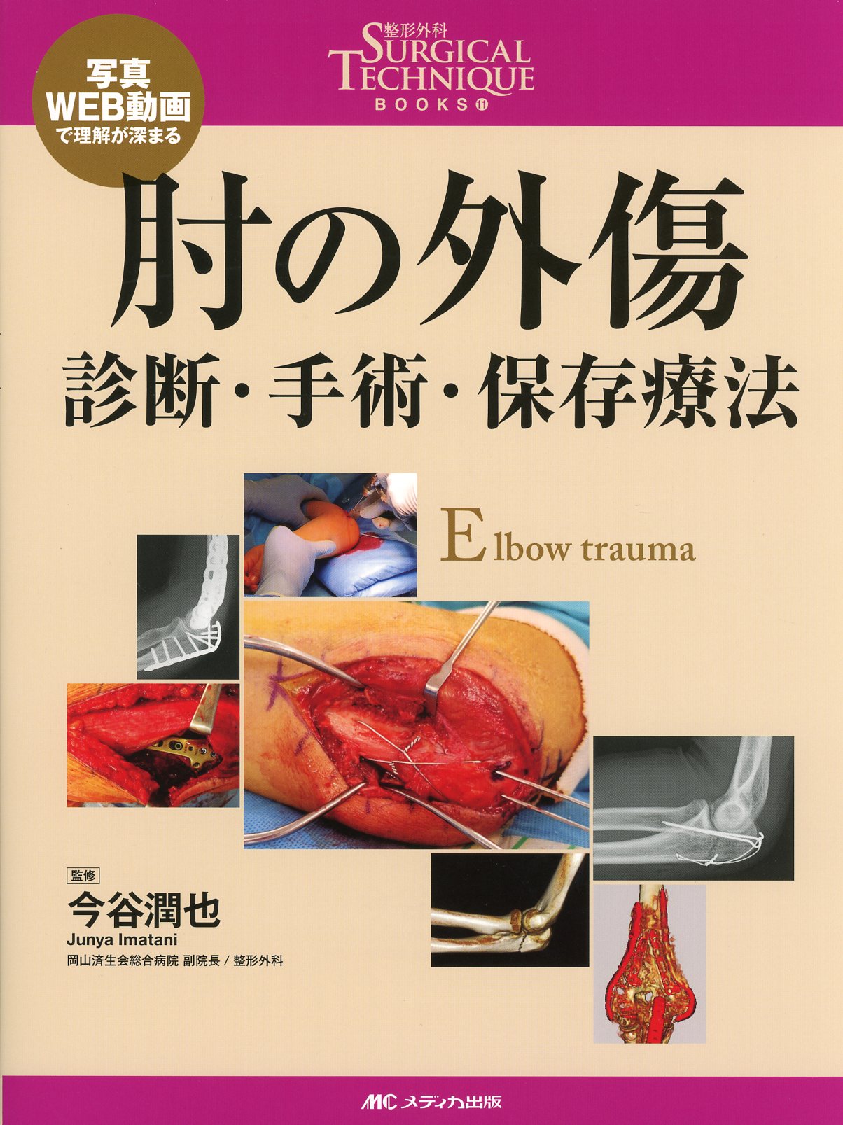 整形外科SURGICAL TECHNIQUE BOOKS 11 写真・WEB動画で理解が深まる 肘の外傷 診断・手術・保存療法