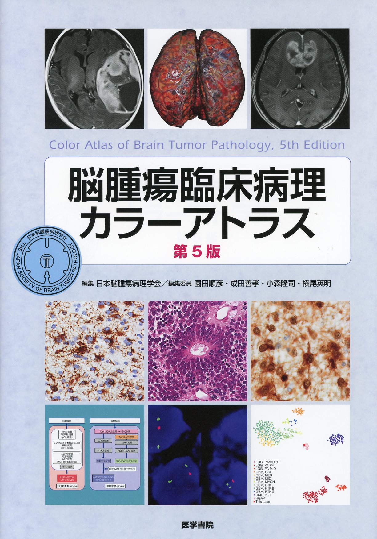 脳腫瘍臨床病理カラーアトラス 第5版 / 高陽堂書店