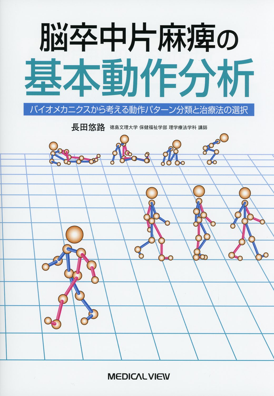 片麻痺の評価と治療