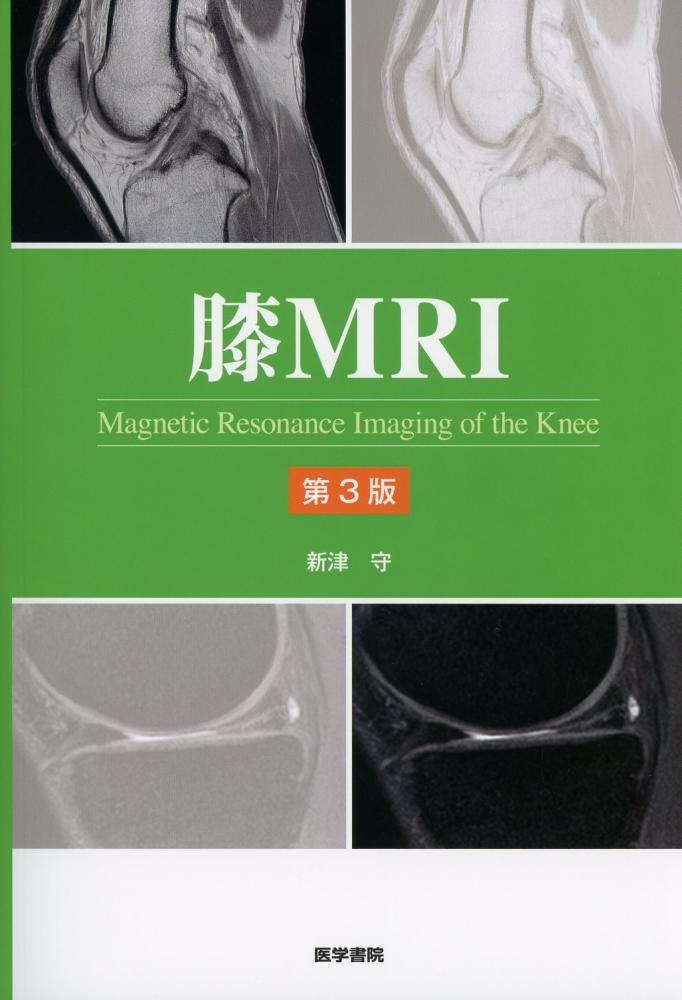 膝MRI　第3版