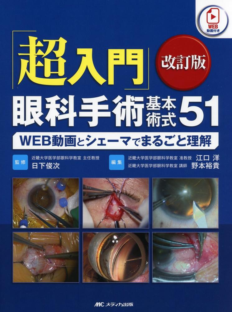 A12146261]「超入門」眼科手術基本術式51 改訂版: WEB動画とシェーマで