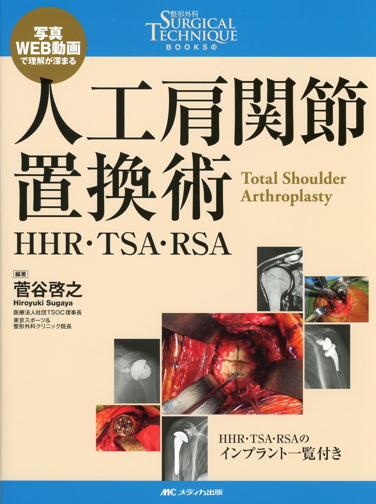 人工肩関節置換術　HHR・TSA・RSA