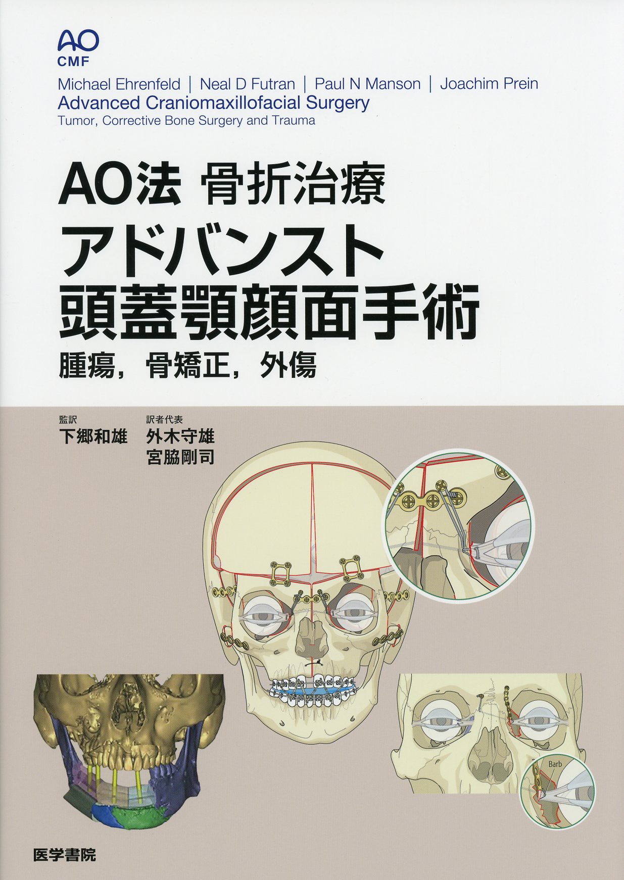 AO法骨折治療 アドバンスト頭蓋顎顔面手術 腫瘍，骨矯正，外傷