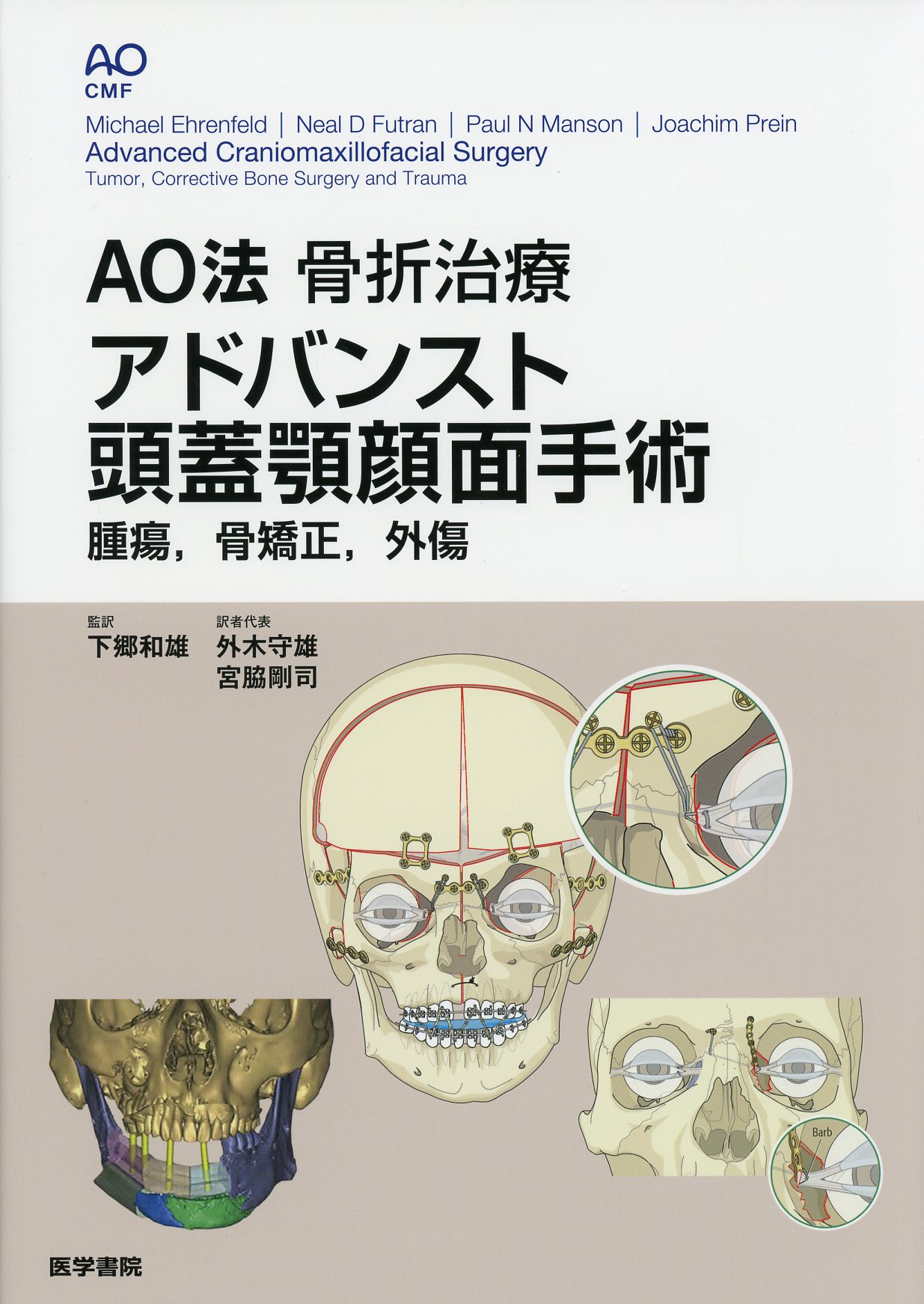 顔面骨骨折の治療の実際 裁断済み - その他