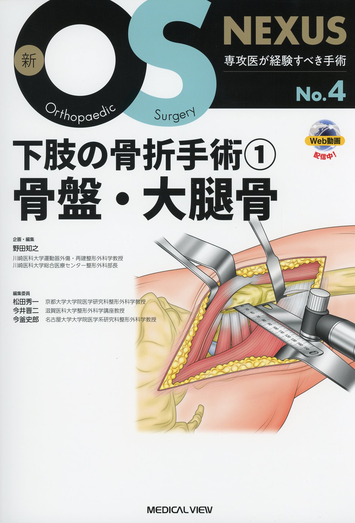 新OS NEXUS　No.4　下肢の骨折手術(1)　骨盤・大腿骨