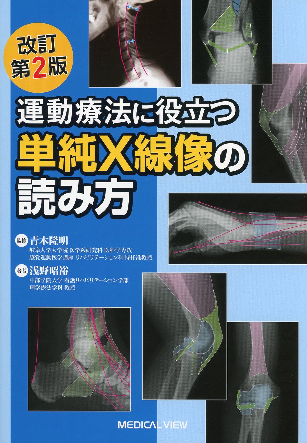 運動療法に役立つ単純X線像の読み方 - 健康・医学