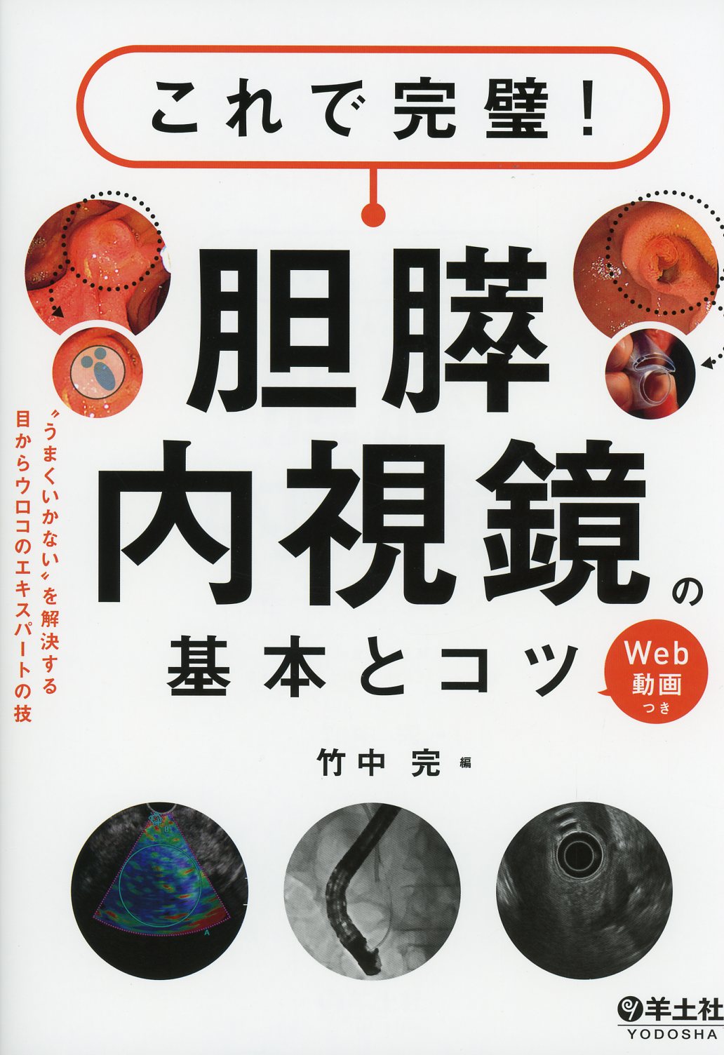 これで完璧！　胆膵内視鏡の基本とコツ