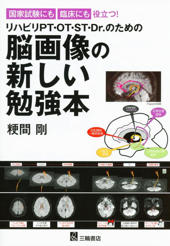 日本に 【裁断済み】脳MRI 3 血管障害・腫瘍・感染症・他 健康・医学 