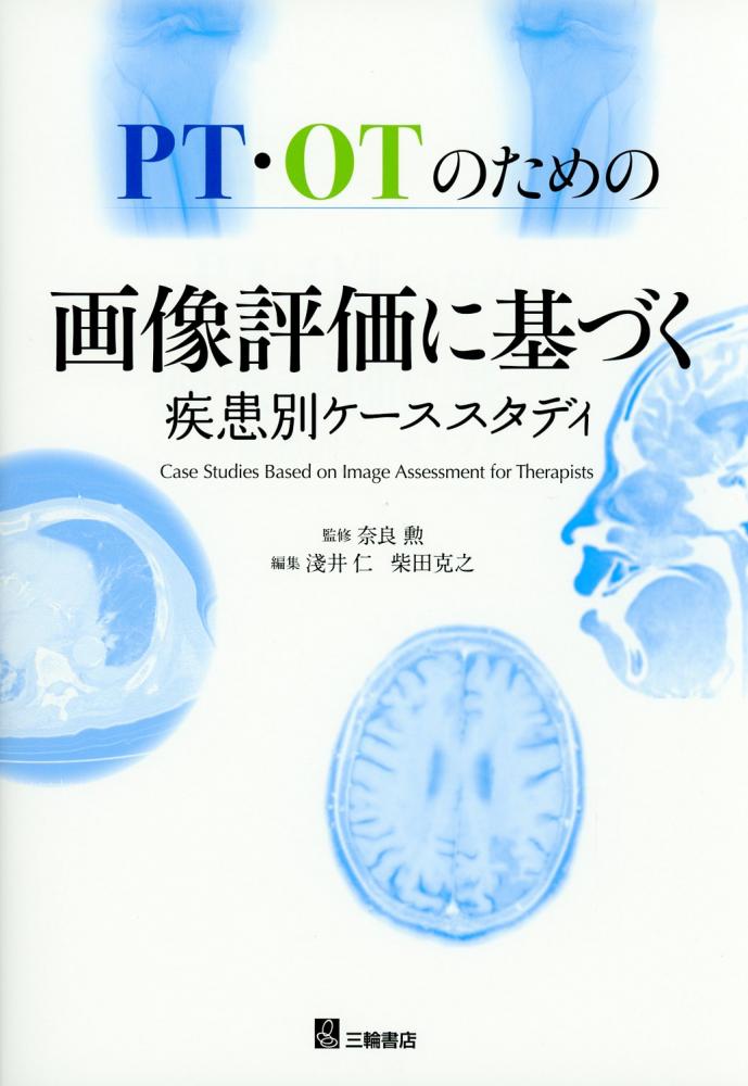 PT・OTのための画像評価に基づく疾患別ケーススタディ