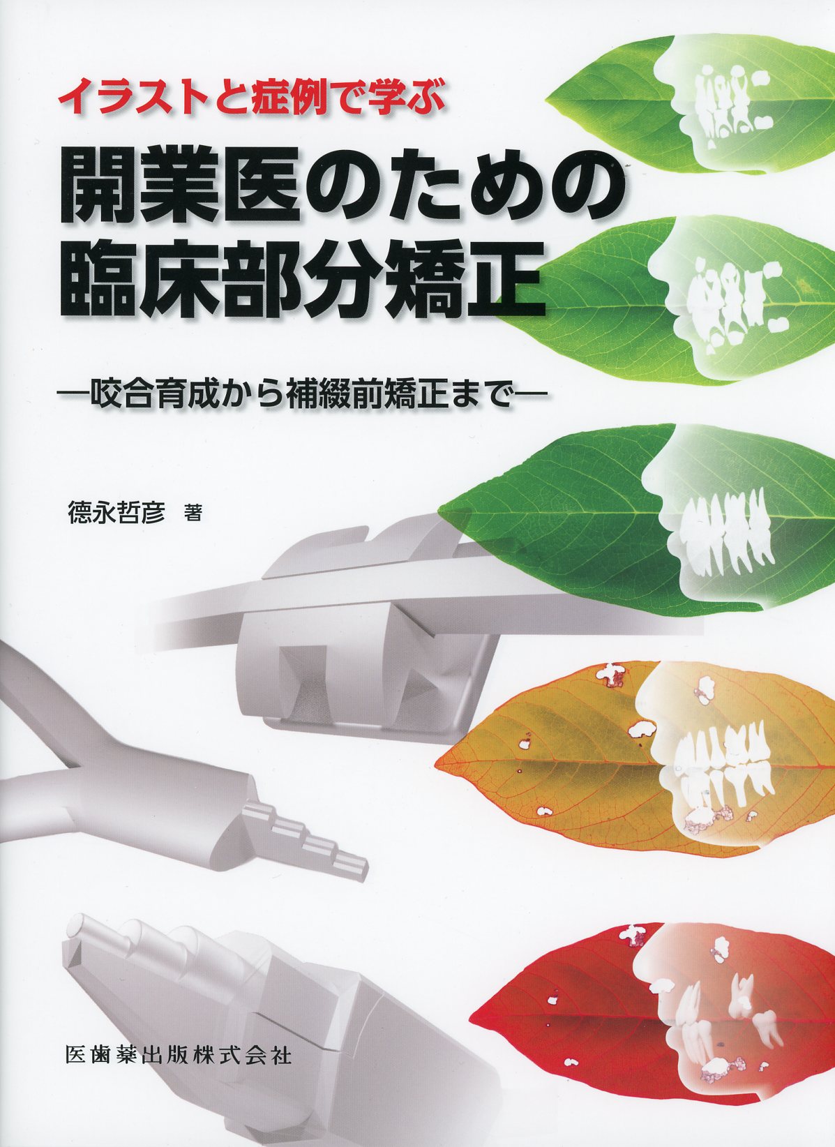 イラストと症例で学ぶ　開業医のための臨床部分矯正